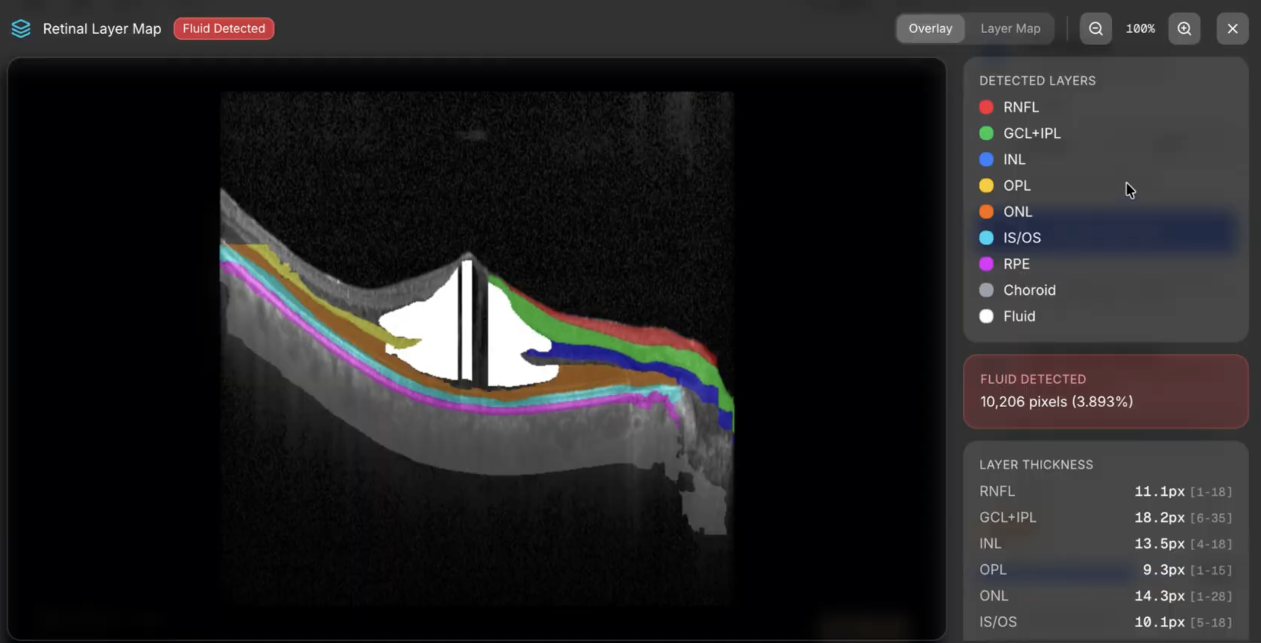 OCT retinal layer segmentation showing 10 colour-coded layers